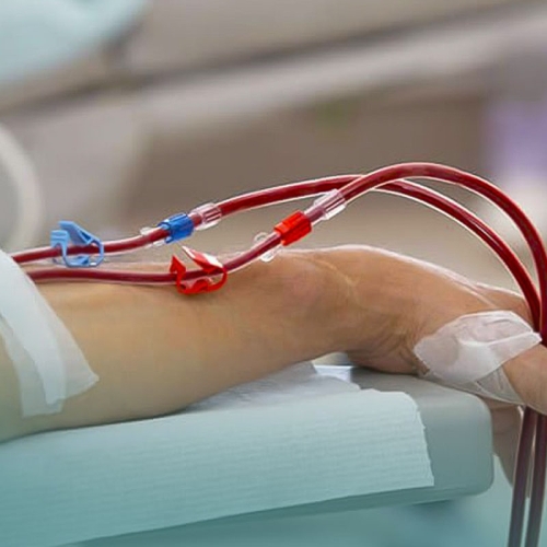 Cientistas de Harvard conseguem regenerar tecidos renais em laboratório