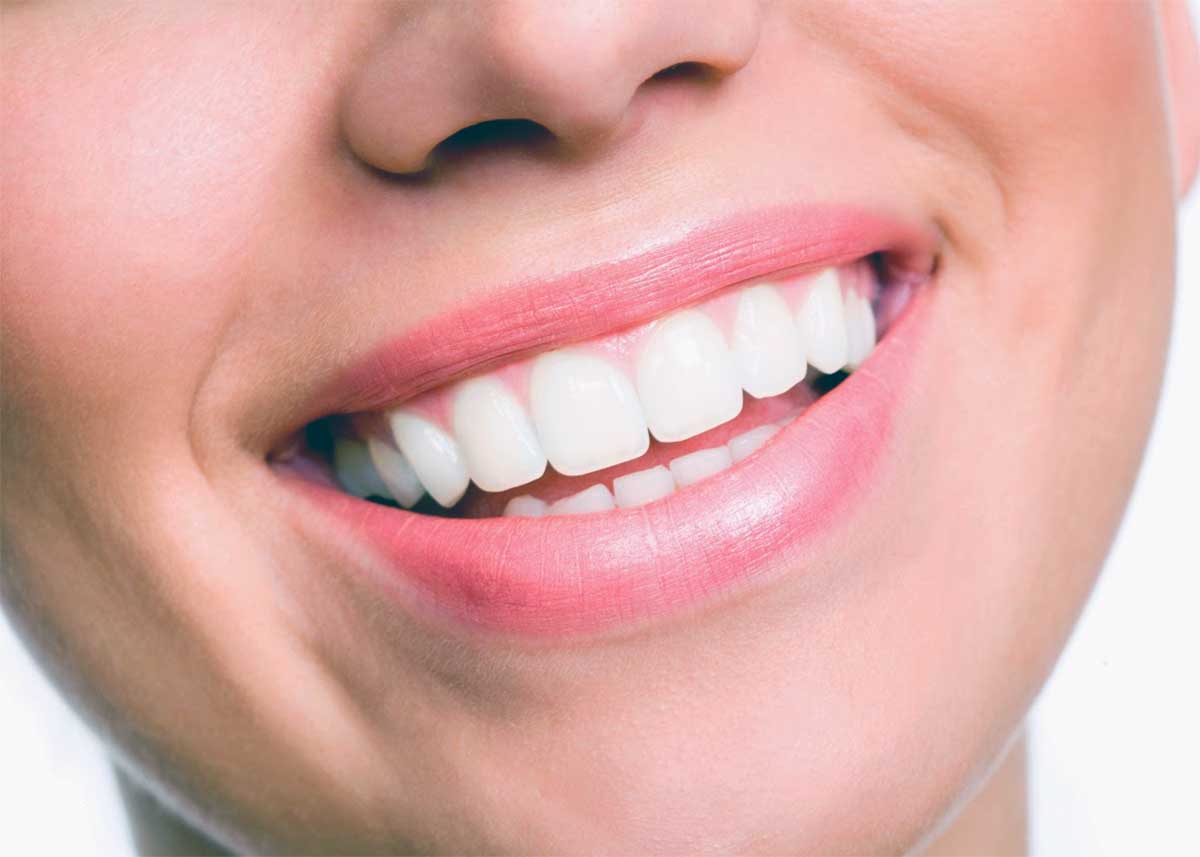 Como limpar o tártaro dos dentes com receitas caseiras